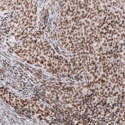 SNF5 Antibody (CL14031) - Azide and BSA Free, Novus Biologicals 100 ul;