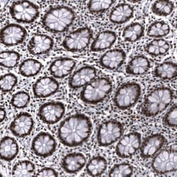 SNF5 Antibody (CL14031) - Azide and BSA Free, Novus Biologicals 100 ul;