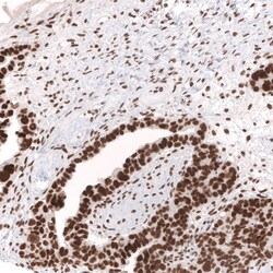 SNF5 Antibody (CL14031) - Azide and BSA Free, Novus Biologicals 100 ul;