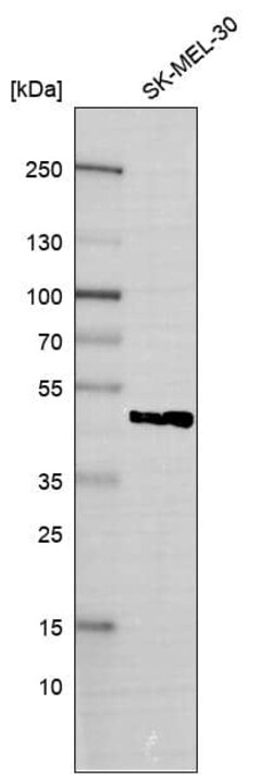 SNF5 Antibody (CL14031) - Azide and BSA Free, Novus Biologicals 100 ul;