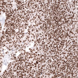 SNF5 Antibody (CL14031) - Azide and BSA Free, Novus Biologicals 100 ul;