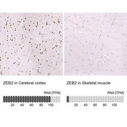 ZEB2 Antibody (CL13467) - Azide and BSA Free, Novus Biologicals 100 ul;