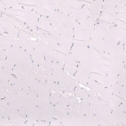ZEB2 Antibody (CL13467) - Azide and BSA Free, Novus Biologicals 100 ul;