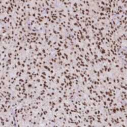 ATRX Antibody (CL0537) - Azide and BSA Free, Novus Biologicals 100 ul;