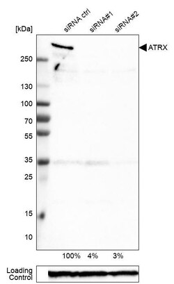 ATRX Antibody (CL0537) - Azide and BSA Free, Novus Biologicals 100 ul;