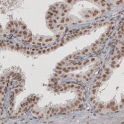 Daxx Antibody (CL3580) - Azide and BSA Free, Novus Biologicals 100 ul;