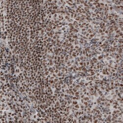 Daxx Antibody (CL3580) - Azide and BSA Free, Novus Biologicals 100 ul;