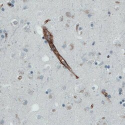 Endoglin/CD105 Antibody (CL1912) - Azide and BSA Free, Novus Biologicals