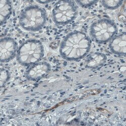 Endoglin/CD105 Antibody (CL1912) - Azide and BSA Free, Novus Biologicals