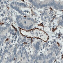 Endoglin/CD105 Antibody (CL1912) - Azide and BSA Free, Novus Biologicals