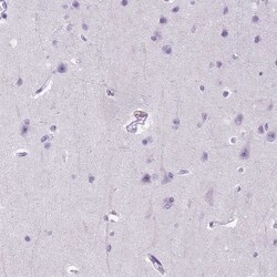 E-Cadherin Antibody (CL1172) - Azide and BSA Free, Novus Biologicals 100