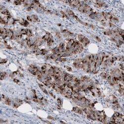 MUC1 Antibody (CL8733) - Azide and BSA Free, Novus Biologicals 100 ul;