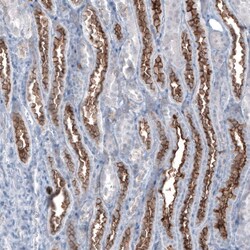 MUC1 Antibody (CL8733) - Azide and BSA Free, Novus Biologicals 100 ul;