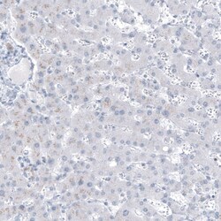 MUC1 Antibody (CL8733) - Azide and BSA Free, Novus Biologicals 100 ul;