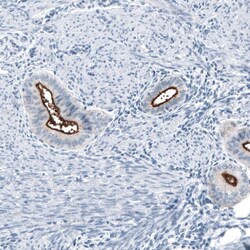 MUC1 Antibody (CL8733) - Azide and BSA Free, Novus Biologicals 100 ul;