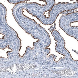 MUC1 Antibody (CL8733) - Azide and BSA Free, Novus Biologicals 100 ul;