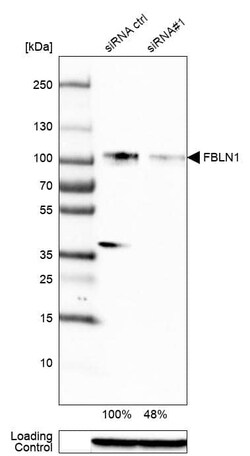 Fibulin 1 Antibody (CL0337) - Azide and BSA Free, Novus Biologicals 100