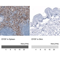 Dysferlin Antibody (CL10888) - Azide and BSA Free, Novus Biologicals 100