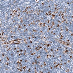 Dysferlin Antibody (CL10888) - Azide and BSA Free, Novus Biologicals 100