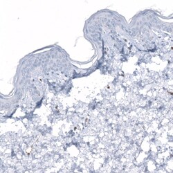 Dysferlin Antibody (CL10888) - Azide and BSA Free, Novus Biologicals 100