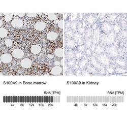 S100A9 Antibody (CL11191) - Azide and BSA Free, Novus Biologicals 100 ul;
