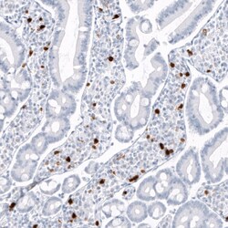S100A9 Antibody (CL11191) - Azide and BSA Free, Novus Biologicals 100 ul;