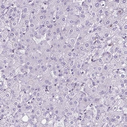 RBM3 Antibody (CL0296) - Azide and BSA Free, Novus Biologicals 100 ul;