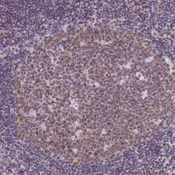 RBM3 Antibody (CL0296) - Azide and BSA Free, Novus Biologicals 100 ul;
