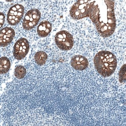 Occludin Antibody (CL1555) - Azide and BSA Free, Novus Biologicals 100