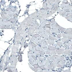 Occludin Antibody (CL1555) - Azide and BSA Free, Novus Biologicals 100