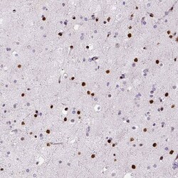 ZEB1 Antibody (CL0151) - Azide and BSA Free, Novus Biologicals 100 ul;