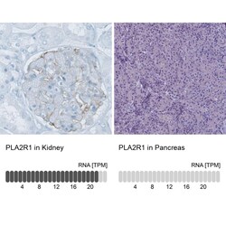 PLA2R1 Antibody (CL0474) - Azide and BSA Free, Novus Biologicals 100 ul;