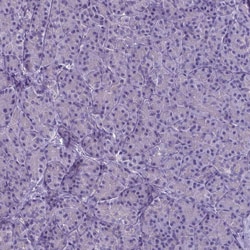 PLA2R1 Antibody (CL0474) - Azide and BSA Free, Novus Biologicals 100 ul;