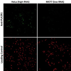 PLA2R1 Antibody (CL0474) - Azide and BSA Free, Novus Biologicals 100 ul;