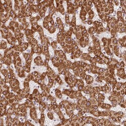 SDHB Antibody (CL0346) - Azide and BSA Free, Novus Biologicals 100 ul;