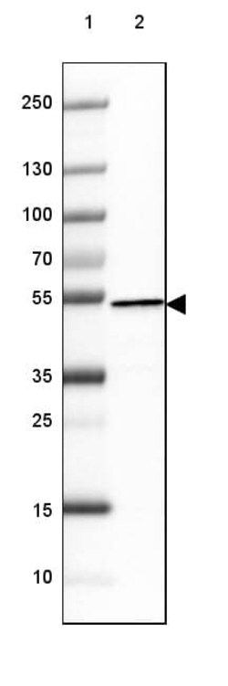 Hsp70 interacting protein HIP Antibody (CL3708) - Azide and BSA Free, Novus