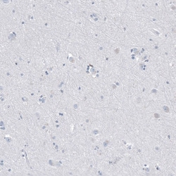 CD20 Antibody (CL10613) - Azide and BSA Free, Novus Biologicals 100 ul;