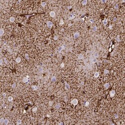 SLC22A2/OCT2 Antibody (CL0631) - Azide and BSA Free, Novus Biologicals