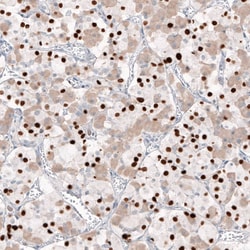 T-box 19 Antibody (CL6251) - Azide and BSA Free, Novus Biologicals 100