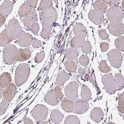 MACC1 Antibody (CL0856) - Azide and BSA Free, Novus Biologicals 100 &mu;L | Buy Online | Novus Biologicals | Fisher Scientific