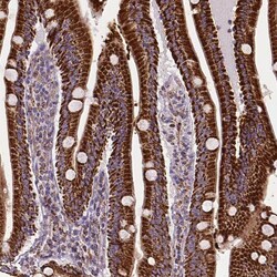 MACC1 Antibody (CL0856) - Azide and BSA Free, Novus Biologicals 100 &mu;L | Buy Online | Novus Biologicals | Fisher Scientific