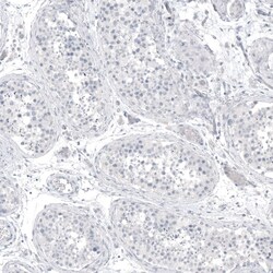 PCP4 Antibody (CL5306) - Azide and BSA Free, Novus Biologicals 100 ul;