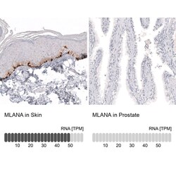 Melan-A/MART-1 Antibody (CL12864) - Azide and BSA Free, Novus Biologicals