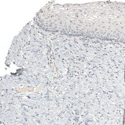 Melan-A/MART-1 Antibody (CL12864) - Azide and BSA Free, Novus Biologicals