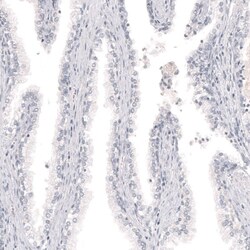 Melan-A/MART-1 Antibody (CL12864) - Azide and BSA Free, Novus Biologicals