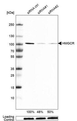 HMG-CoA Reductase/HMGCR Antibody (CL0260) - Azide and BSA Free, Novus Biologicals