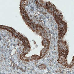 DIAPH-2 Antibody (CL1111) - Azide and BSA Free, Novus Biologicals 100 ul;