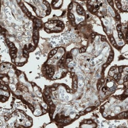 DIAPH-2 Antibody (CL1111) - Azide and BSA Free, Novus Biologicals 100 ul;