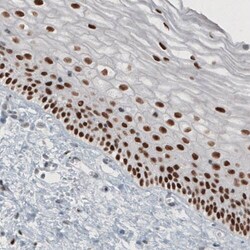TLE3 Antibody (CL3573) - Azide and BSA Free, Novus Biologicals 100 &mu;L | Buy Online | Novus Biologicals | Fisher Scientific