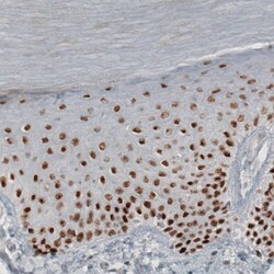 TLE3 Antibody (CL3573) - Azide and BSA Free, Novus Biologicals 100 &mu;L | Buy Online | Novus Biologicals | Fisher Scientific